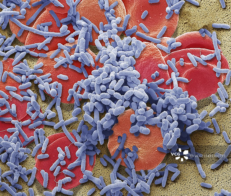 败血症扫描电镜图图片素材