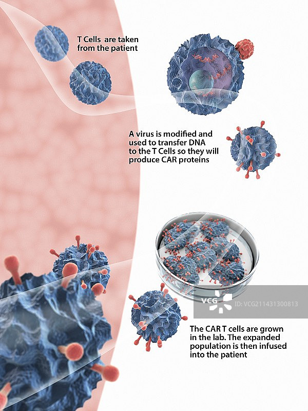 CAR T细胞癌症免疫疗法图片素材
