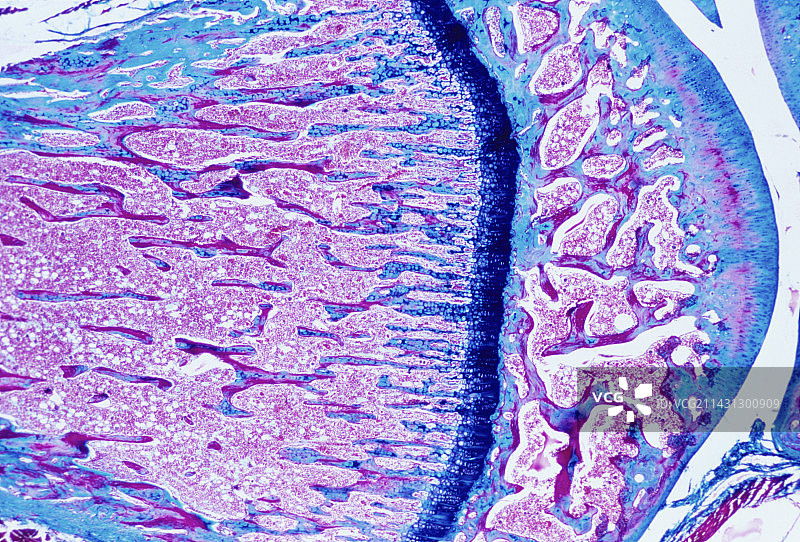 骨骼生长图片素材