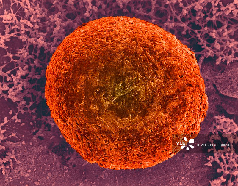 人卵细胞扫描电镜图图片素材