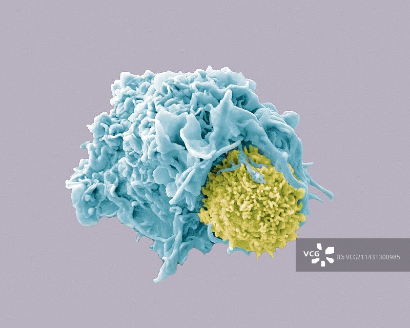 树突状细胞和淋巴细胞扫描电镜图图片素材