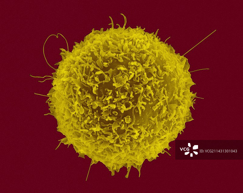 人T淋巴细胞，扫描电子显微镜图片素材