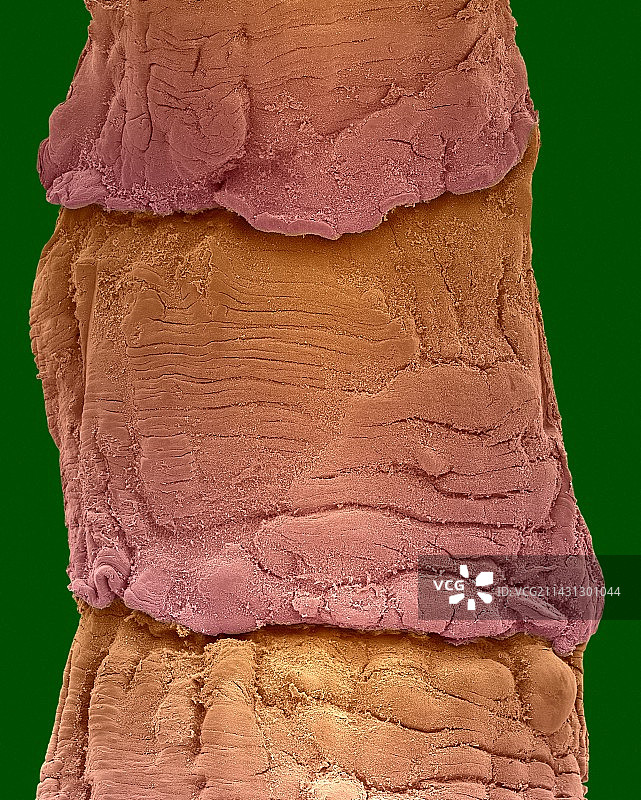 绦虫孕节（绦虫属），扫描电镜图片素材
