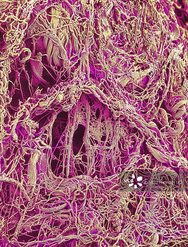 胶原纤维扫描电镜图图片素材