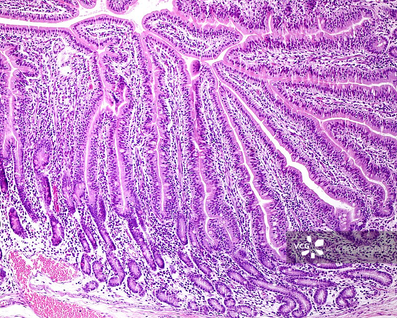 小肠粘膜光学显微照片图片素材