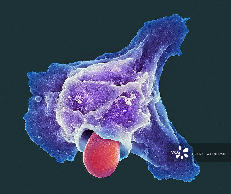 中性粒细胞吞噬鹅口疮真菌，扫描电镜图片素材