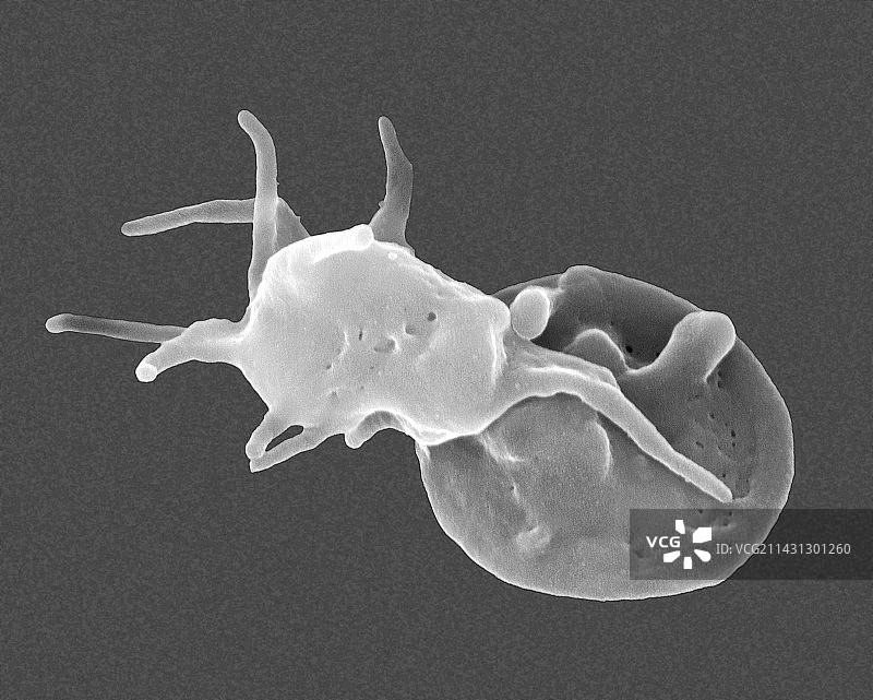 激活和部分激活的血小板，扫描电镜图片素材