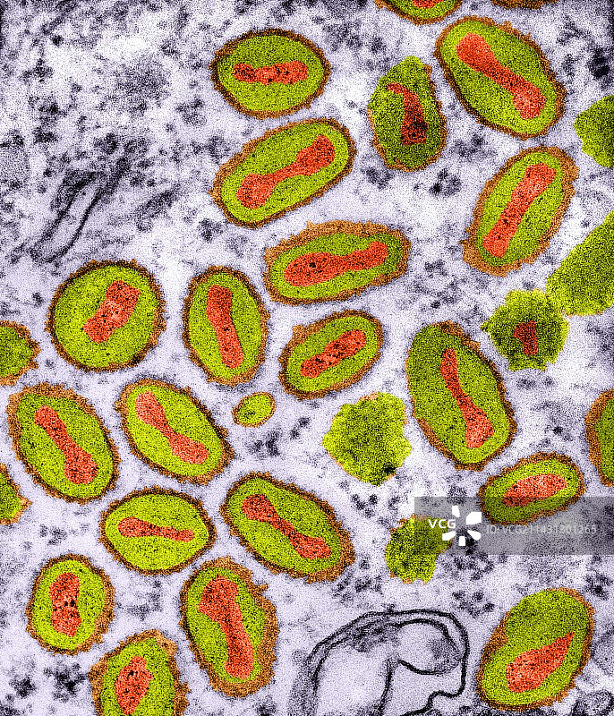 牛痘病毒，TEM图片素材