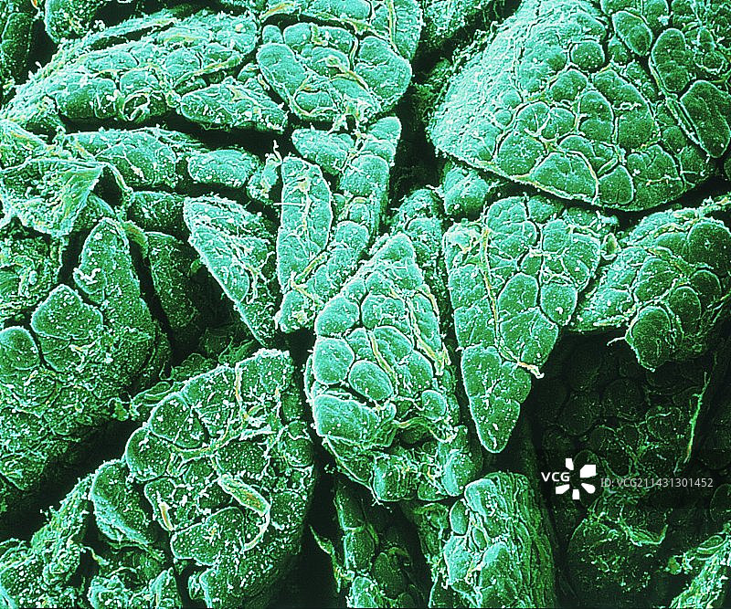 胰腺细胞，扫描电镜图片素材