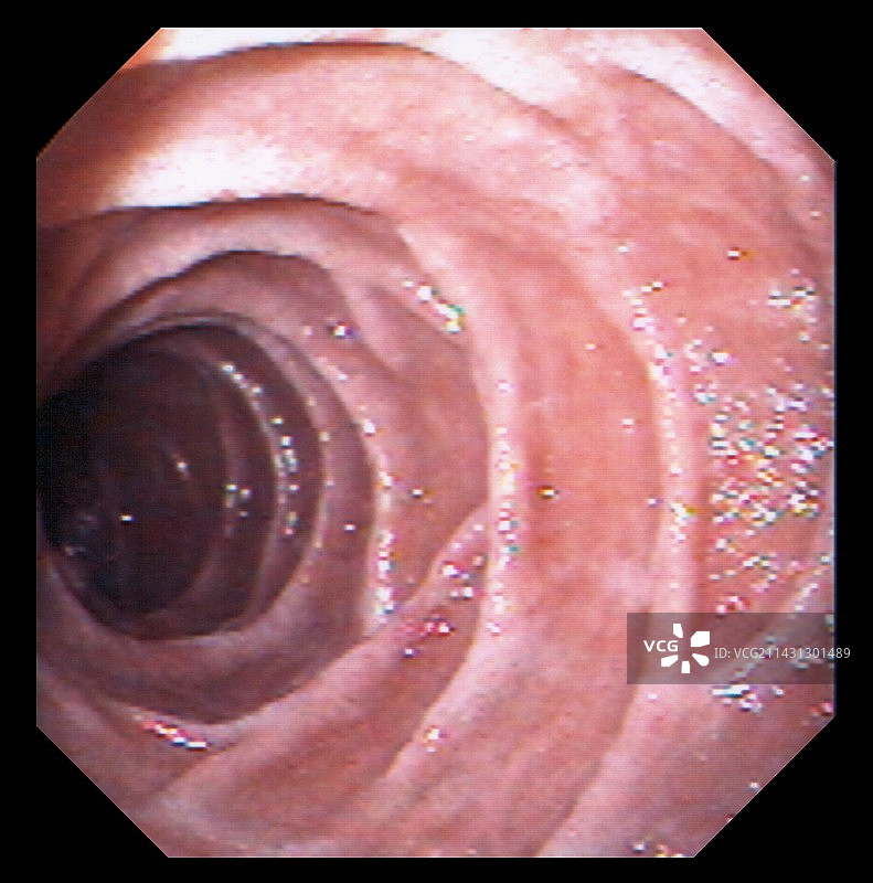 十二指肠图片素材