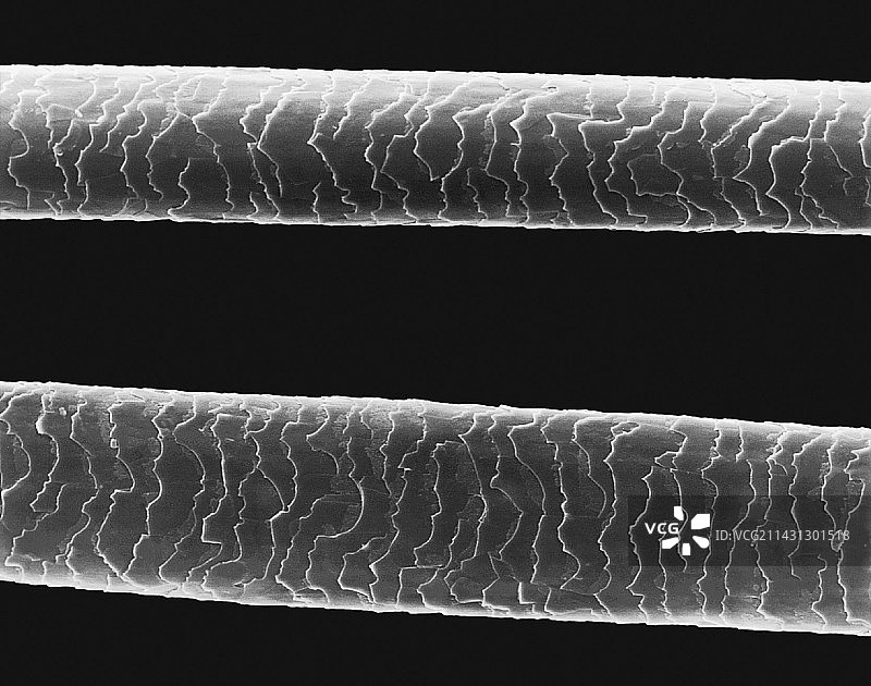 人类头发扫描电镜图图片素材