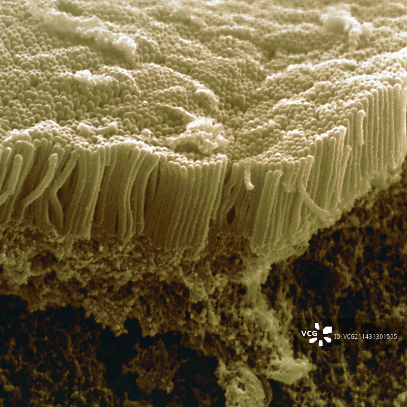 小肠微绒毛扫描电镜图图片素材