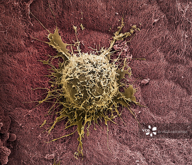 软骨上的骨髓干细胞（扫描电镜）图片素材