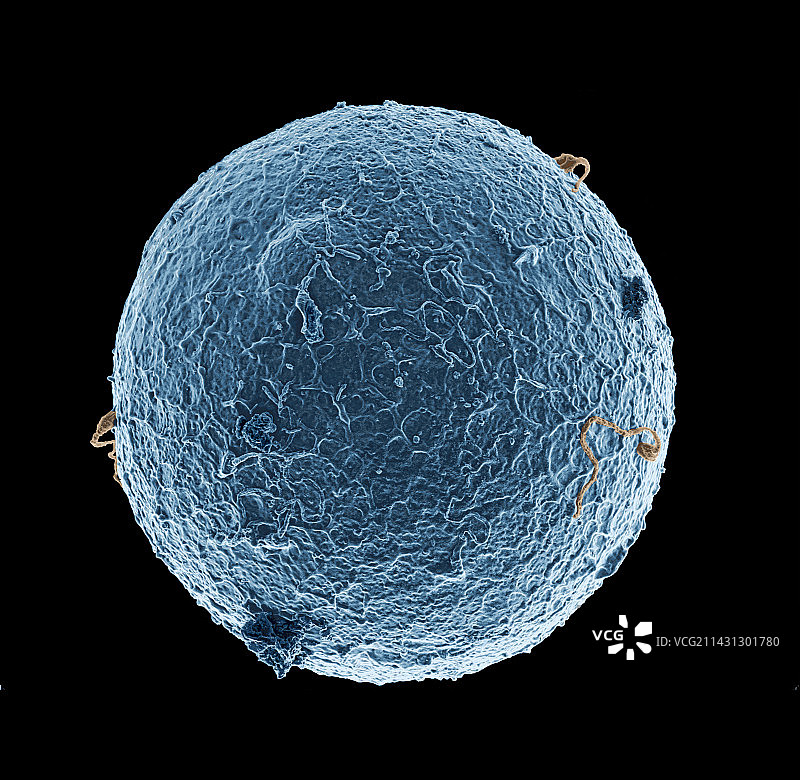 人卵细胞和精子细胞扫描电镜图图片素材