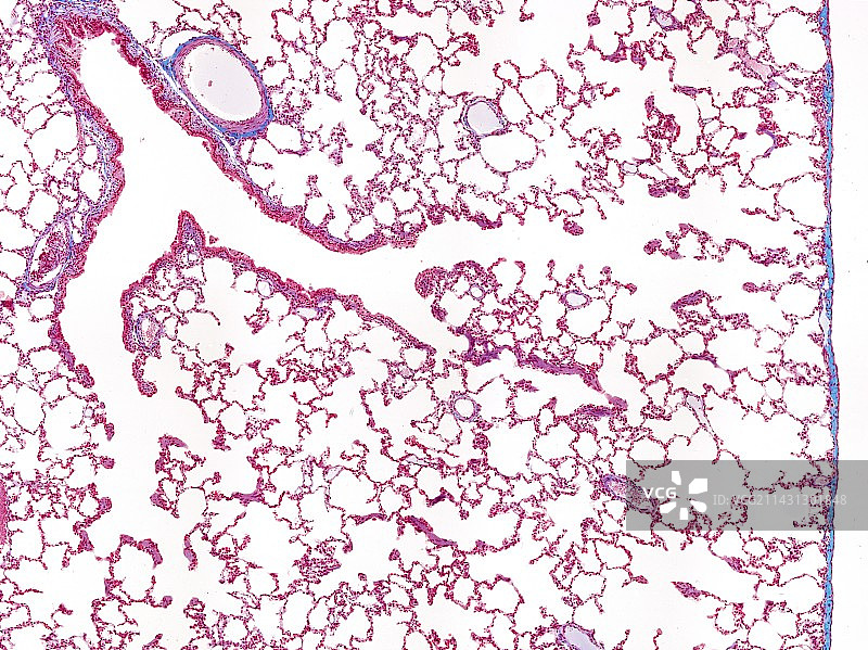 肺部显微照片图片素材