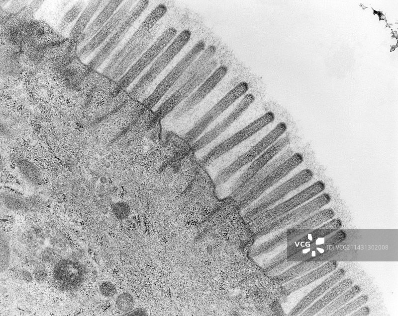 小肠微绒毛的透射电镜图图片素材