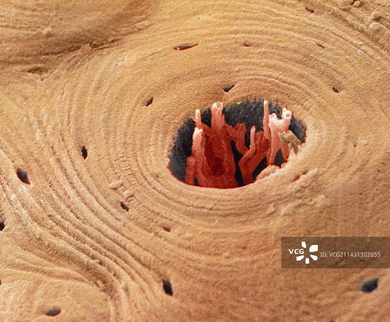 致密骨横截面，SEM图片素材