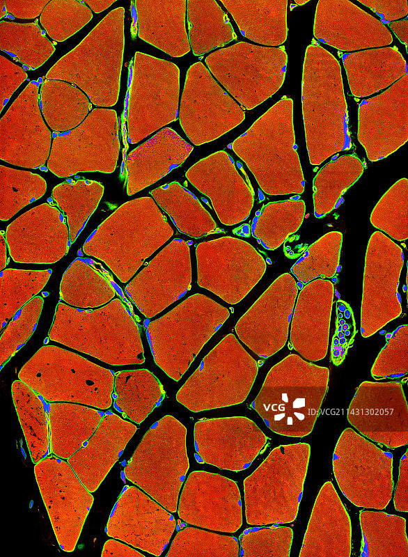 骨骼肌纤维，光学显微照片图片素材