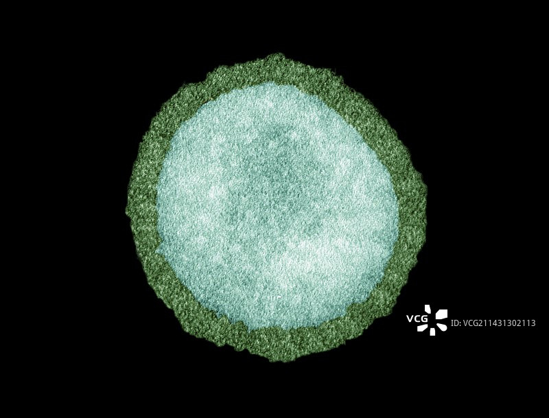 流感病毒颗粒（透射电子显微镜）图片素材
