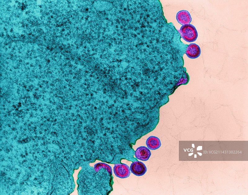 淋巴组织中的艾滋病毒感染，透射电镜图片素材