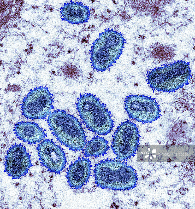 猴痘病毒颗粒，TEM图片素材