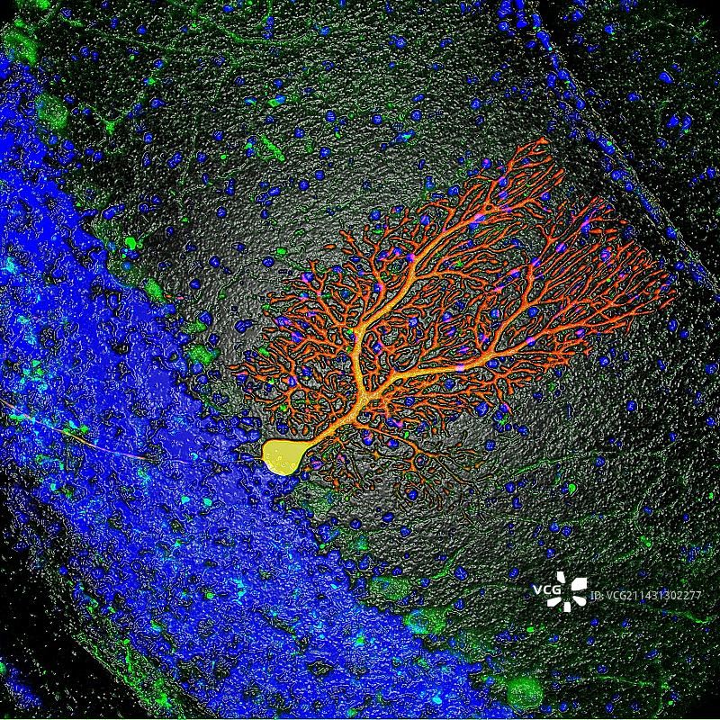 浦肯野神经细胞图片素材