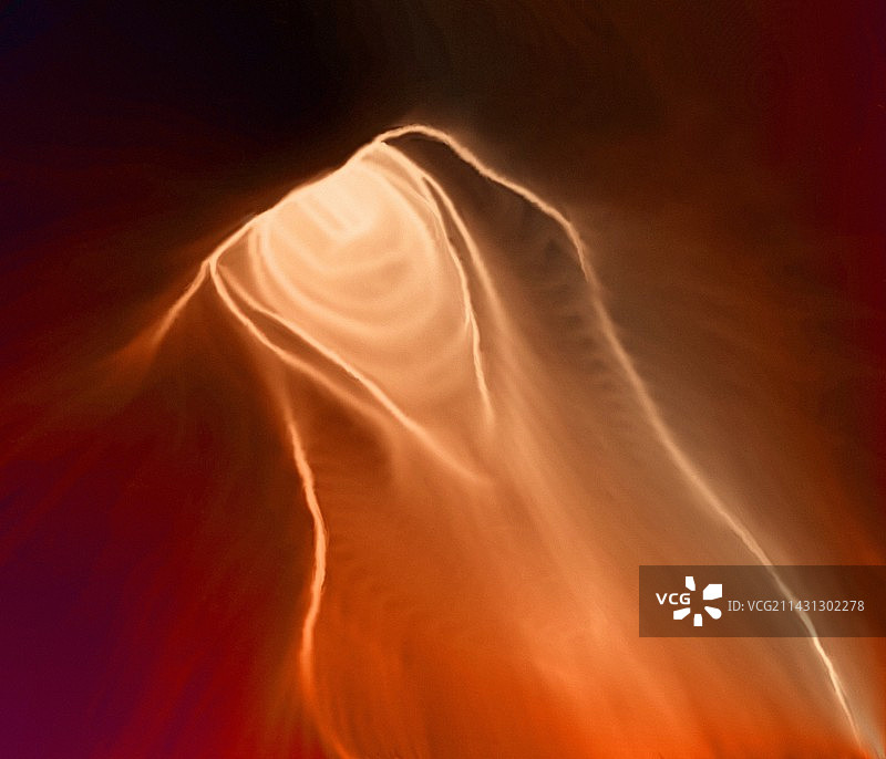 3D CT扫描声带图片素材