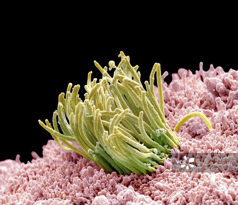 输卵管，扫描电镜图片素材