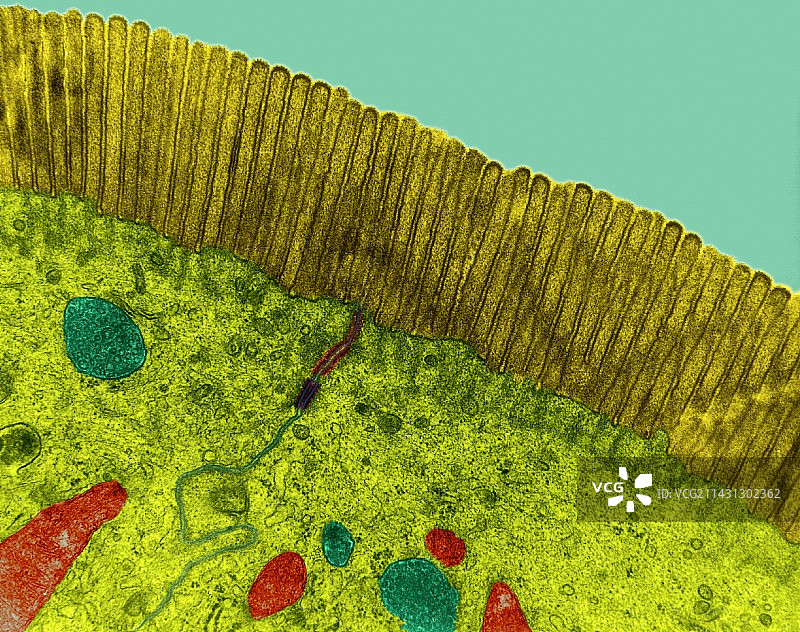 小肠微绒毛电镜照片图片素材