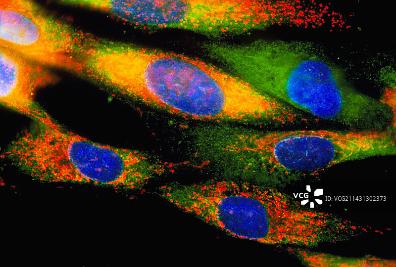 巨细胞病毒感染图片素材