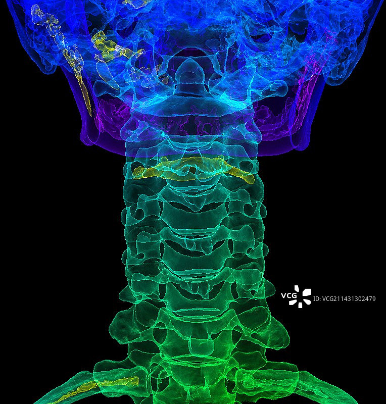 颈椎解剖结构3D CT扫描图片素材