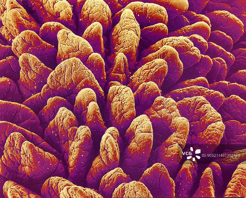 小肠绒毛，扫描电镜图片素材