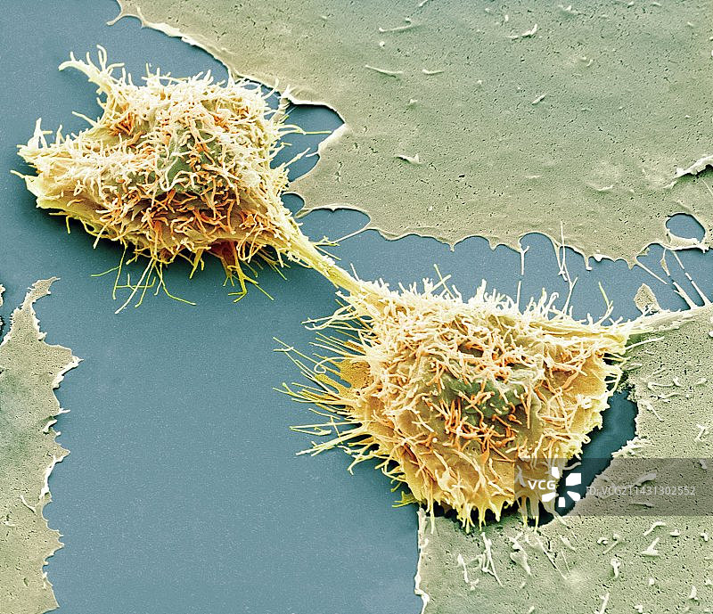 HeLa细胞分裂（扫描电镜）图片素材