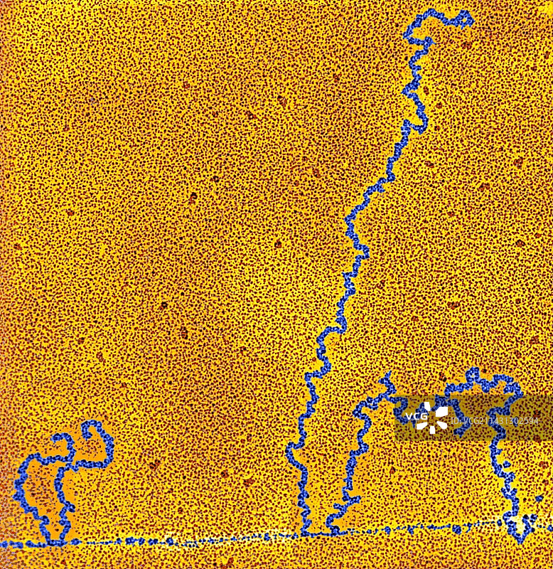 DNA转录，透射电子显微镜图片素材
