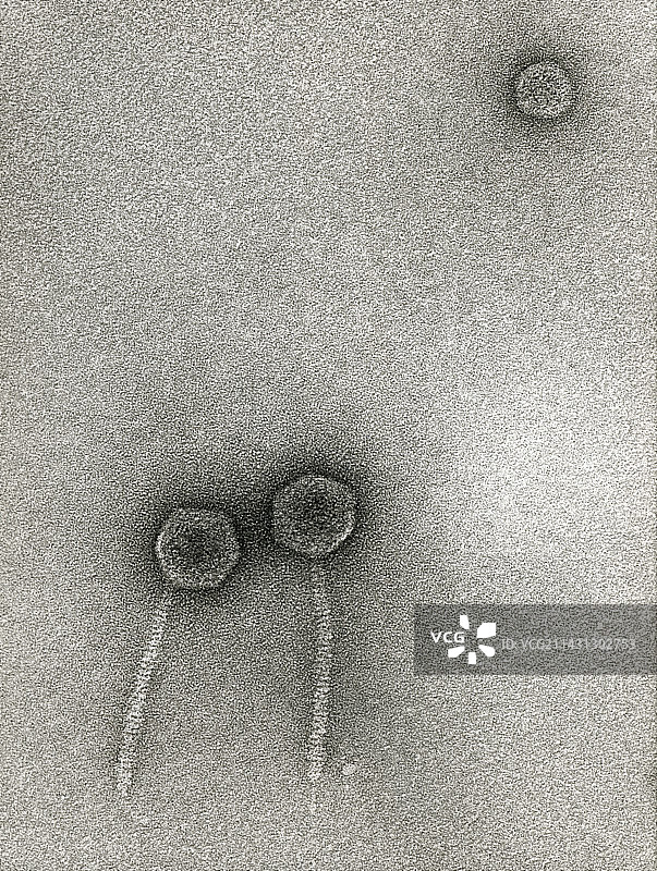 λ噬菌体透射电镜图像图片素材
