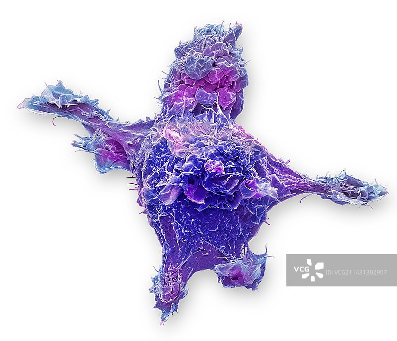 腺病毒感染的293T细胞扫描电镜图图片素材