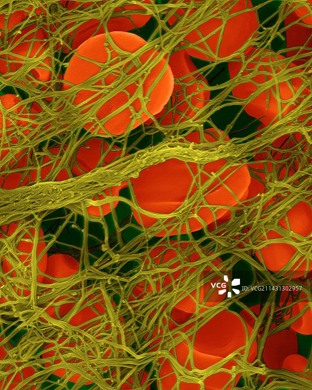 血凝块中的红细胞，SEM图片素材