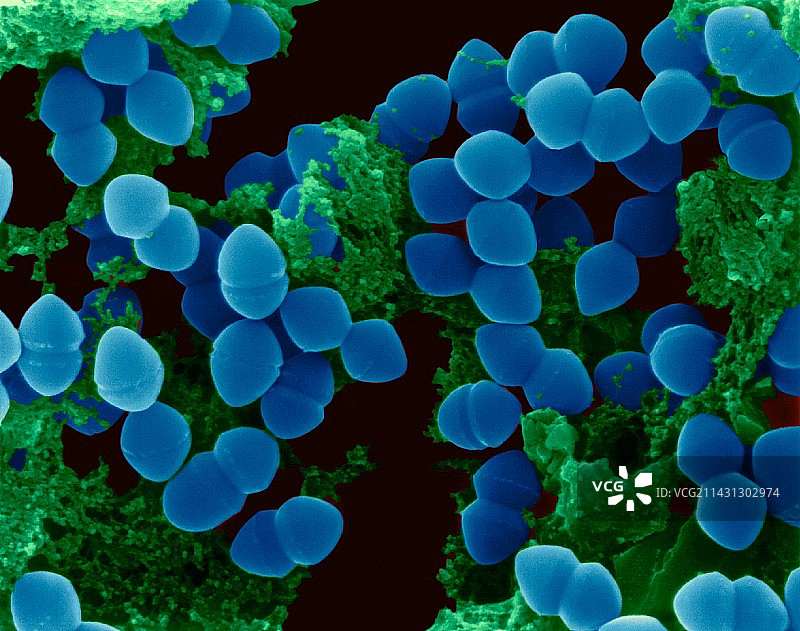 屎肠球菌，球状原核生物，扫描电镜图片素材