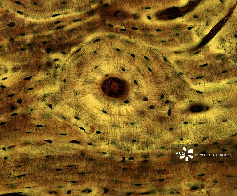 骨骼结构显微照片图片素材