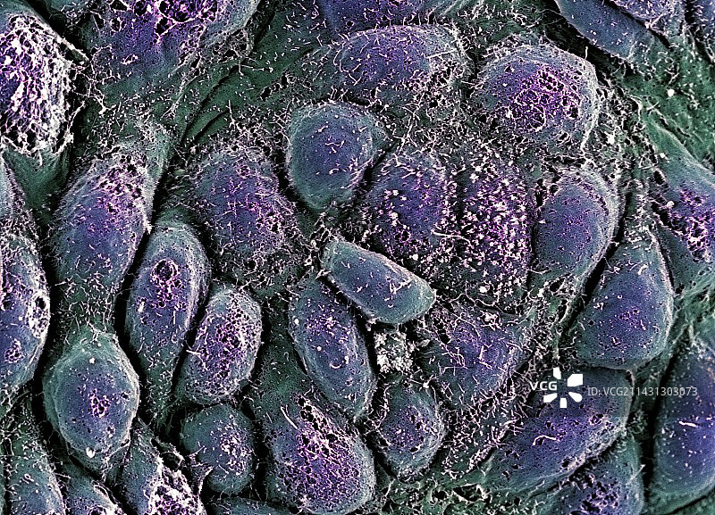 胚胎干细胞扫描电镜图图片素材