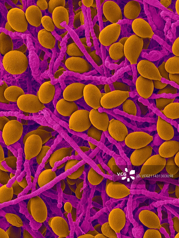 链孢霉菌真菌病原体，扫描电镜图片素材