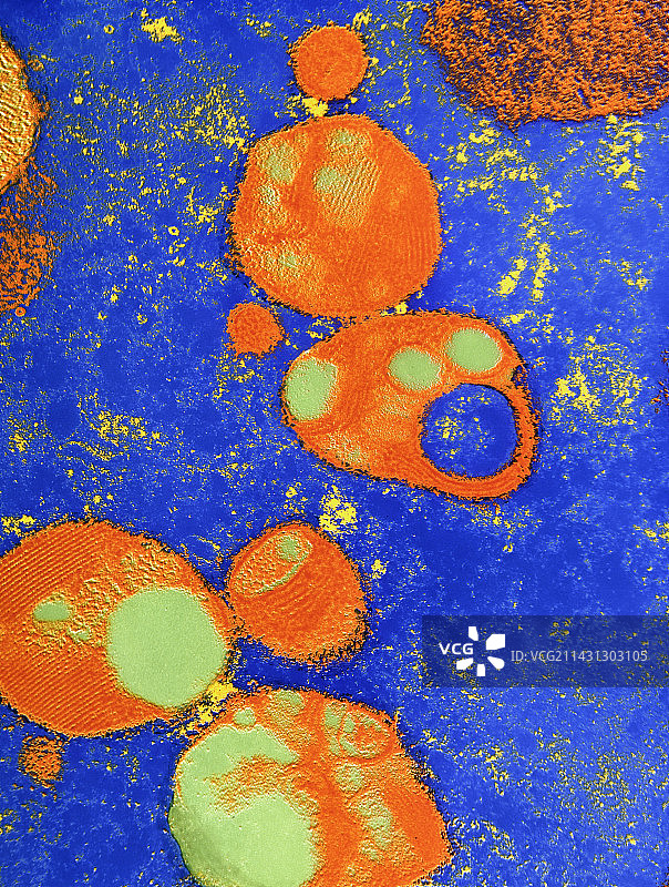 肾细胞中溶酶体的透射电镜图像图片素材