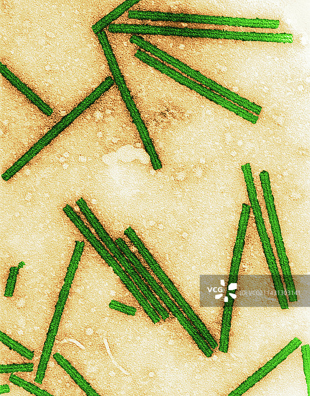 烟草花叶病毒TEM图片素材