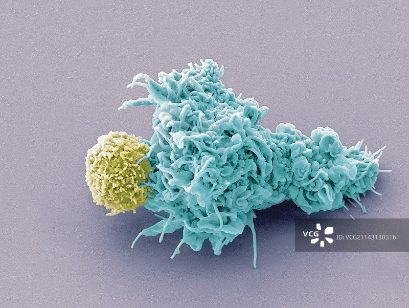 树突状细胞和淋巴细胞扫描电镜图图片素材