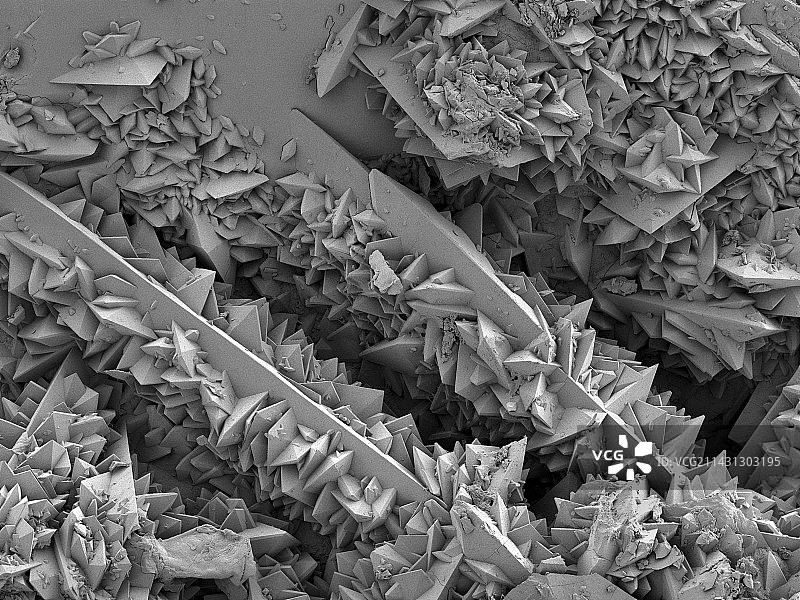 肾结石表面扫描电镜图图片素材