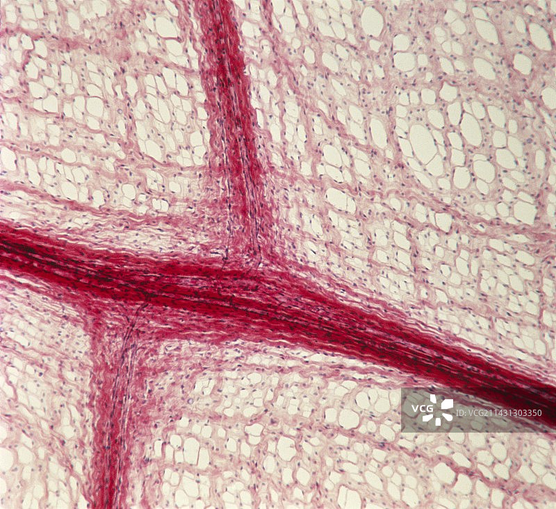 毛细血管网络（光学显微照片）图片素材