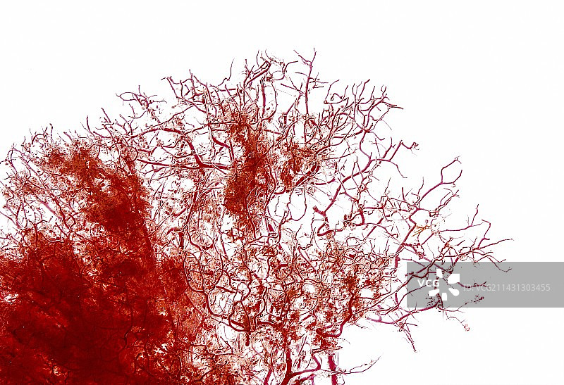 肾脏血液供应的树脂模型图片素材