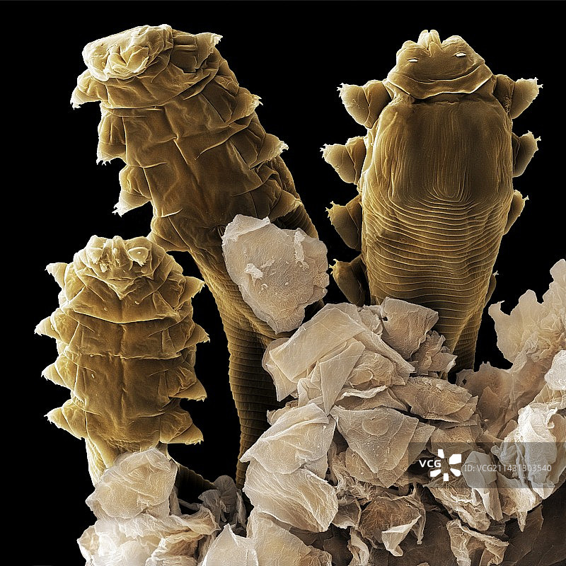 毛囊螨头部（扫描电子显微镜）图片素材