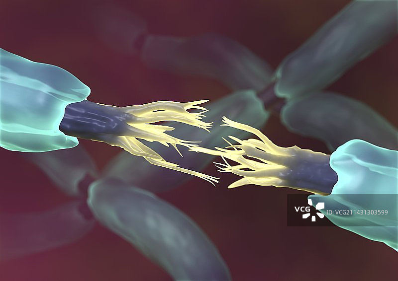 神经切断，艺术作品图片素材