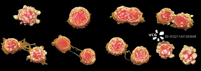 癌细胞分裂扫描电镜图片素材